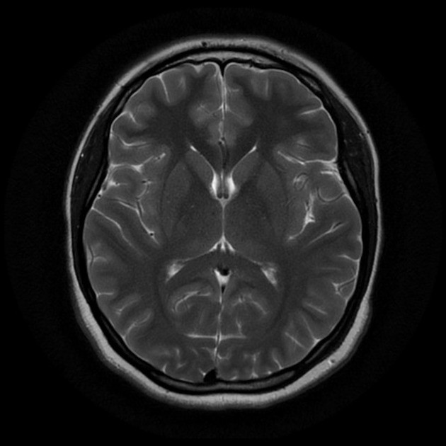 Комплексная МРТ головы